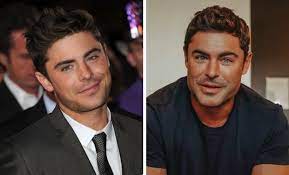 The musical, zac efron has sparked rumors of plastic surgery. Dhmarr V24ftem