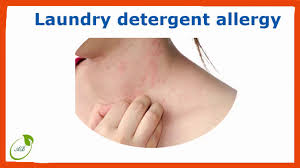 What are common side effects of nsaids? Laundry Detergent Allergy Youtube