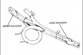 Ima forceps or dennis micro/ring forceps. Flow Analysis In Vascular Shunts That Bypass The Carotid Artery Semantic Scholar