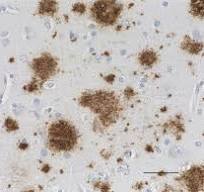 Purified anti-beta-Amyloid, 17-24 Antibody anti-beta-Amyloid ...