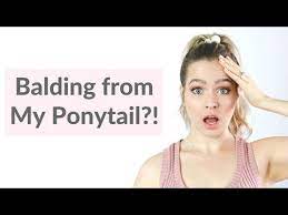31 Hairline Saving Ponytail Hack No More Thinning Or Balding Youtube Hair Hacks Bald Hair Thinning Hairline Thinning Hairline Hair Hacks Bald Hair