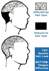 But some women experience hair loss. What Happens When Hair Loss Is Not Genetic