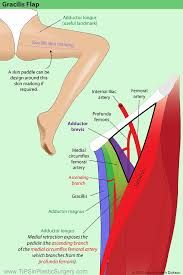 Image result for Laggera gracilis