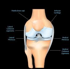 Depending on the size and location this can develop into a bucket handle tear or may respond to a meniscus repair surgery if in the. Arthroscopic Knee Surgery Your Meniscectomy Recovery Plan