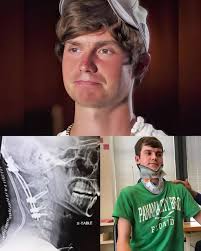 Youth injured in accident at Saltaire Mills in 1891