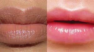 Akan tetapi cara tersebut tetap saja kurang memuaskan karena hanya bersifat sementara. Mengatasi Bibir Hitam Jadi Cerah Secara Alami Manfaatkan Bahan Rumah Ini Serambi Indonesia