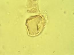 Image result for Icacinaceae