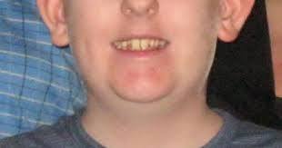 Feb. 12 MDA Face of the Day: Dalton Boyd