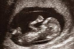 Schwanger Ihr Baby 11 Wochen Alt Ssw 13 Babywelten Ch