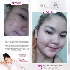 Brilliant Skin Essentials UAE