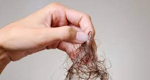 The average person loses somewhere between 50 and 100 strands of hair per day, according to the american academy of dermatology.yes, that's a lot, so don't panic if you see a few strands in. How Much Hair Loss Per Day Is Normal