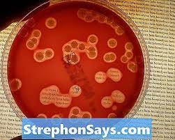 We did not find results for: Perbedaan Antara Alpha Dan Beta Hemolisis Perbedaan Antara 2021