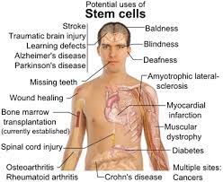 Major Breakthrough In Stem Cell Hair Regrowth Treatments