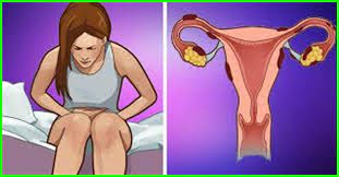 home remes to relieve menstrual crs