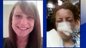 Grand Strand mom who suffered bitten-off nose to appear