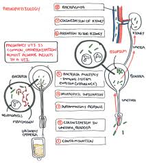 Urinary Tract Infection Armando Hasudungan