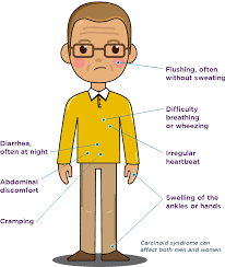 Understanding Gastrointestinal Symptoms And Carcinoid Syndrome Carcinoid Syndrome Gastrointestinal Syndrome