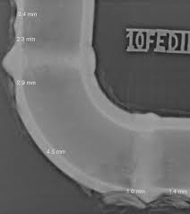 Rekod kesihatan kanak kanak taska; Enabling Safe And Efficient On Stream Pipeline Inspection With Computed Radiography Durr Ndt