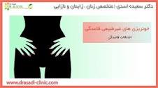 عمل لابیاپلاستی چیست ؟ | دکتر سعیده اسدی ٬ متخصص زنان - YouTube