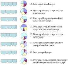 Scielo Brasil Quadricuspid Aortic Valve A Comprehensive Review Quadricuspid Aortic Valve A Comprehensive Review