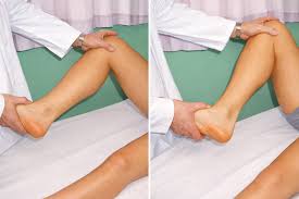 Image result for McMurray Test