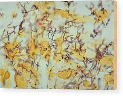 Image result for Treponema