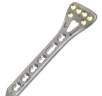Spyrox Dura line Distal Radius Plate, 2.4/2.7 mm, (Volar ...
