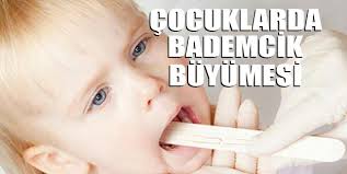 cocuklarda bademcik buyumesi nasil anlasilir