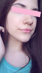 Otvety Mail Ru Nos Kartoshkoj Kak Ispravit