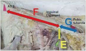 Ligamentum inguinale nedir ve ligamentum inguinale ne demek sorularına hızlı cevap veren sözlük sayfası. Fig 4 Photograph Of A Cadaver Specimen Showing An Anteroposterior View Of The Right Thigh Between The Inguinal Ligament And The Obturator Nerve Exit Zone Of The Foramen After Soft Tissue Dissection E The Shortest Distance From The Obturator Nerve Exit Zone