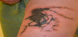 Avşa adasında tatildeyim, deniz anası falan var. Denizanasi Hakkinda Bilinmeyen 10 Gercek