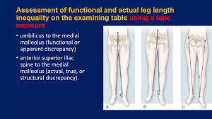 Image result for Functional Leg Length Discrepancy