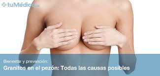 Granitos En El Pezon Todas Las Causas Posibles