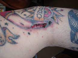My New Tattoo Is Swollen Red And Bruised Is This Normal Infected Tattoo New Tattoos Tattoos