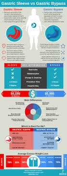 Gastric Sleeve Surgery Vs Gastric Bypass Surgery Pros And Cons Infographic Bypass Surgery Diet Gastric Sleeve Surgery Bariatric Surgery Diet
