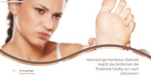 Hartnackige Hornhaut Deshalb Macht Das Entfernen Die Probleme Haufig