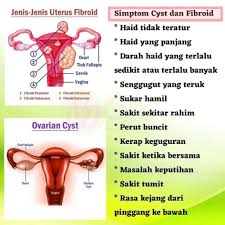 Kebiasaannya cyst ni tidak menunjukkan sebarang tanda,sebab itu ia jarang di kesan awal pada ibu hamil, cyst di kesan secara tidak sengaja oleh doktor pada trimester pertama kehamilan. Facebook