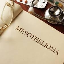 A lawsuit brought by a railroad worker under fela can typically be brought in any state or federal court. Mesothelioma Attorneys In Savannah Spiva Law Group