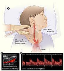 This tutorial covers basic ultrasound physics, different. Medical Ultrasound Wikipedia