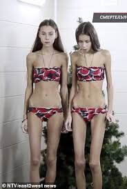 Official model mayhem page of hanna f; Teens Turned Into Living Corpses After Russian Modelling School Told Them To Lose Weight Daily Mail Online