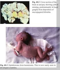 Neonatology At A Glance Medical Laboratory Science Pediatrics Medical Laboratory Scientist