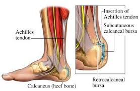 Pin On Achilles Tendonitis