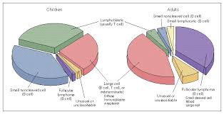 Non Hodgkins Lymphoma In Childhood Nejm