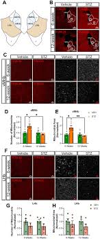 Frontiers | STZ-induced hyperglycemia differentially influences  mitochondrial distribution and morphology in the habenulointerpeduncular  circuit