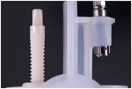 Single Crown Restorations Supported by One-Piece Zirconia Dental Implants:  Case Series with a Mean Follow-Up of 58 Months