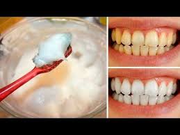 Come Sbiancare I Denti A Casa Tua In Modo Naturale E In Soli 3 Minuti Youtube Estetica Nel 2019 Sbiancamento Naturale Dei Denti Rimedi Casalinghi E Rimedi Naturali