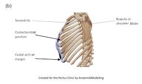 Xiphoid process, costal arch, 12th and 11th ribs, vertebra t12. Complex Chest Wall Injury Rib Injury Clinic