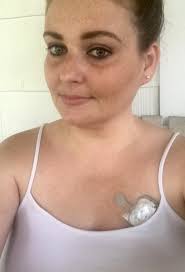 Experiences with nsvt report from holter monitor?