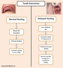 The healing procedure after tooth extraction. Tooth Extraction Aftercare Tooth Extraction Aftercare Wisdom Teeth Tooth Extraction