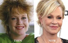 Linda evangelista on magazinevogue has openly talked that she has botox treatment to maintain her … Melanie Griffith Plastic Surgery You Can Download Melanie Flickr